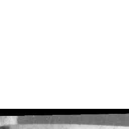 Image Tile