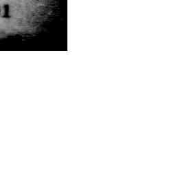 Image Tile